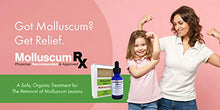 Load image into Gallery viewer, MolluscumRx (1 Bottle &amp; Soap) REFERRED &amp; Sold by Dermatologists Nationwide! Pain-Free! Organic! Guaranteed!
