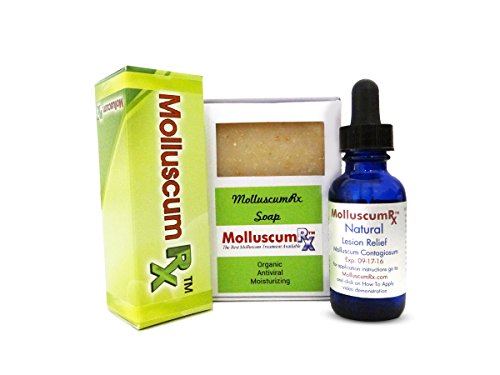 MolluscumRx (1 Bottle & Soap) REFERRED & Sold by Dermatologists Nationwide! Pain-Free! Organic! Guaranteed!